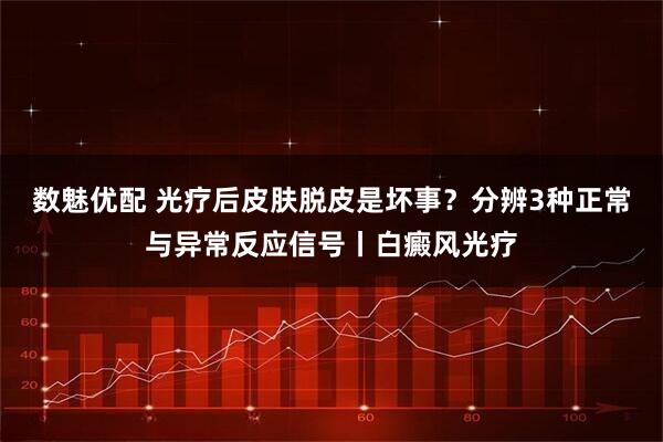 数魅优配 光疗后皮肤脱皮是坏事？分辨3种正常与异常反应信号丨白癜风光疗